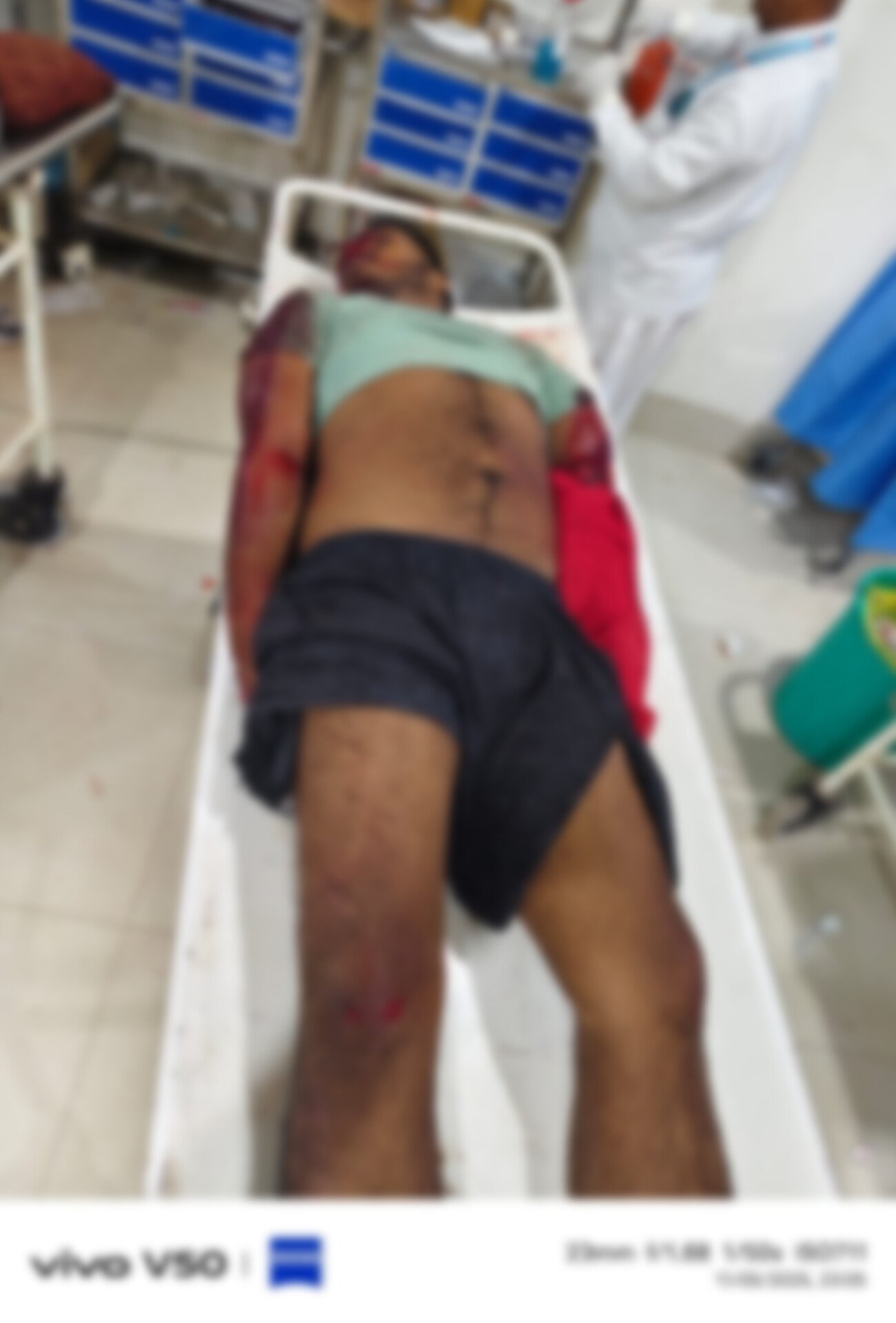 ट्रक से टकराई बाइक, हादसे में एक युवक की मौत, दो गंभीर, वाराणसी से देव दिवाली देखकर लौट रहे थे बाइक सवार, नेशनल हाईवे-19 पर हुआ हादसा