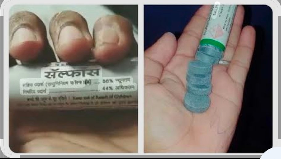 चंदौली में सल्फास खाकर आत्महत्या करने वालों की बढ़ी संख्या: 120 रुपये में दुकान पर आसानी से मिल जाती है सल्फास की टिकिया, विशेषज्ञों ने कहा—एक गोली से मर सकते हैं बीस लोग