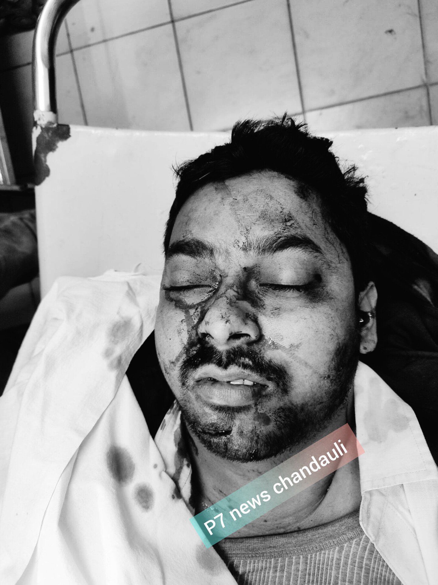 Chandauli News : सड़क हादसे में रोडवेज चालक की मौत : जयपुरिया स्कूल के पास अज्ञात वाहन ने मोटरसाइकिल में मारी जोरदार टक्कर, परिजनों में मचा कोहराम