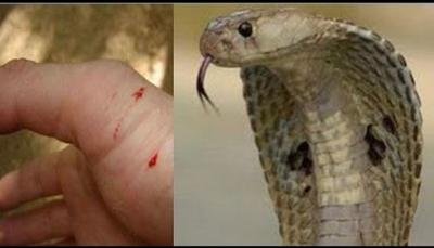 चंदौली में सर्पदंश की शिकार हुईं 19 वर्षीय युवती : दोपहर के समय सांप ने काटा, अस्पताल में चल रहा इलाज