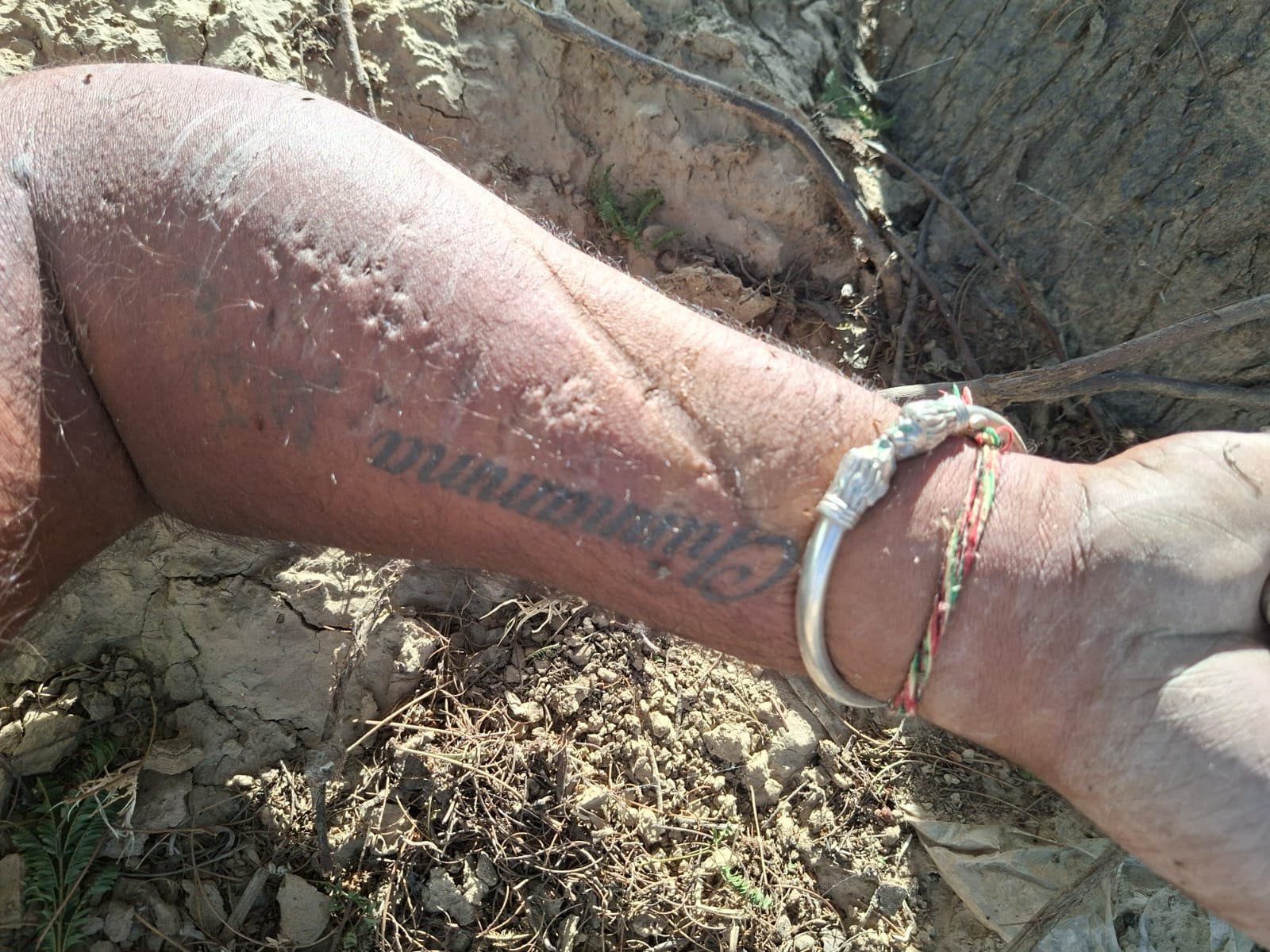 कटेसर में बबूल के पेड़ से लड़का मिली युवक की लाश, हाथ पर ‘चिन्नम्मा नाम’ का टैटू, साउथ इंडिया का होने की आशंका, पहचान में जुटी पुलिस