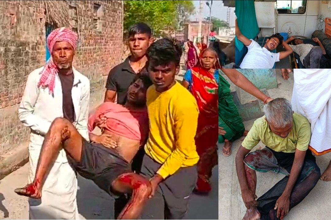 चंदौली के तेल्हारा गांव में पुराने विवाद में राइफल से फायरिंग: 10 लोग हुए घायल, एसपी ने कहा कुत्ता टहलाने को लेकर हुआ झगड़ा P-7 न्यूज पर पढ़े पूरी खबर