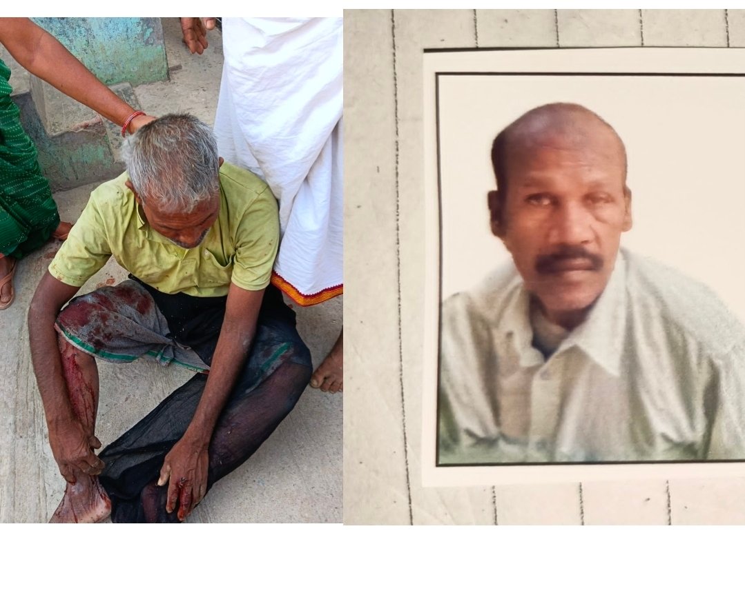 चंदौली के तेल्हरा गोलीकांड में घायल श्यामलाल की मौत: कुत्ते को टहलाने के विवाद से शुरू हुआ था दो परिवार के बीच ख़ूनी संघर्ष, फायरिंग में 7 लोग हुए थे घायल
