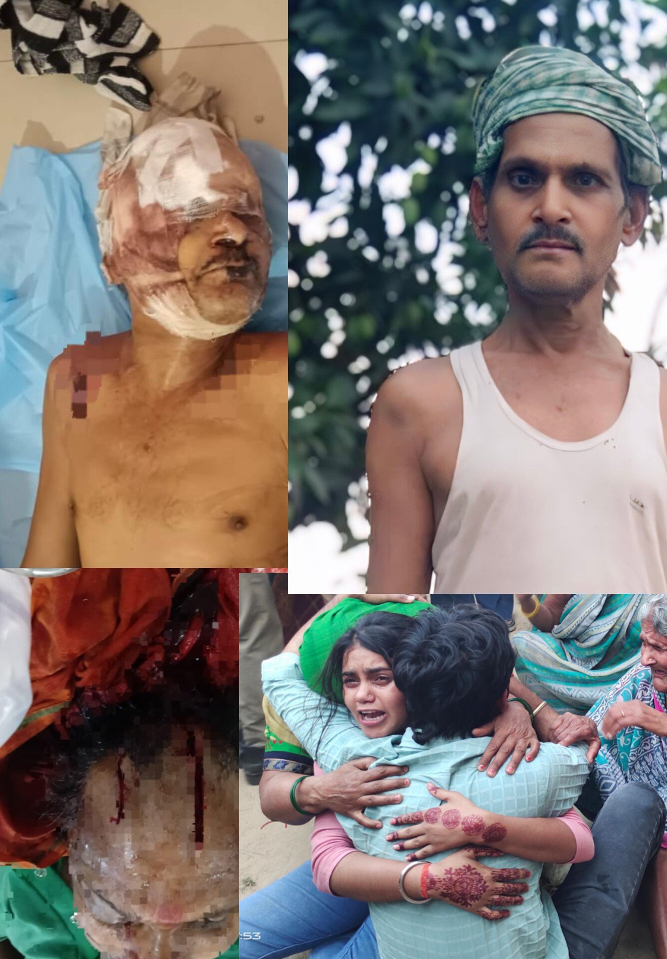 चंदौली के गजधरा में पहले पिलाई शराब फिर दोस्त ने ही दोस्त को धारदार हथियार से किया वार: इलाज के दौरान अधेड़ की ट्रामा सेंटर में हुई मौत, गांव में तनाव