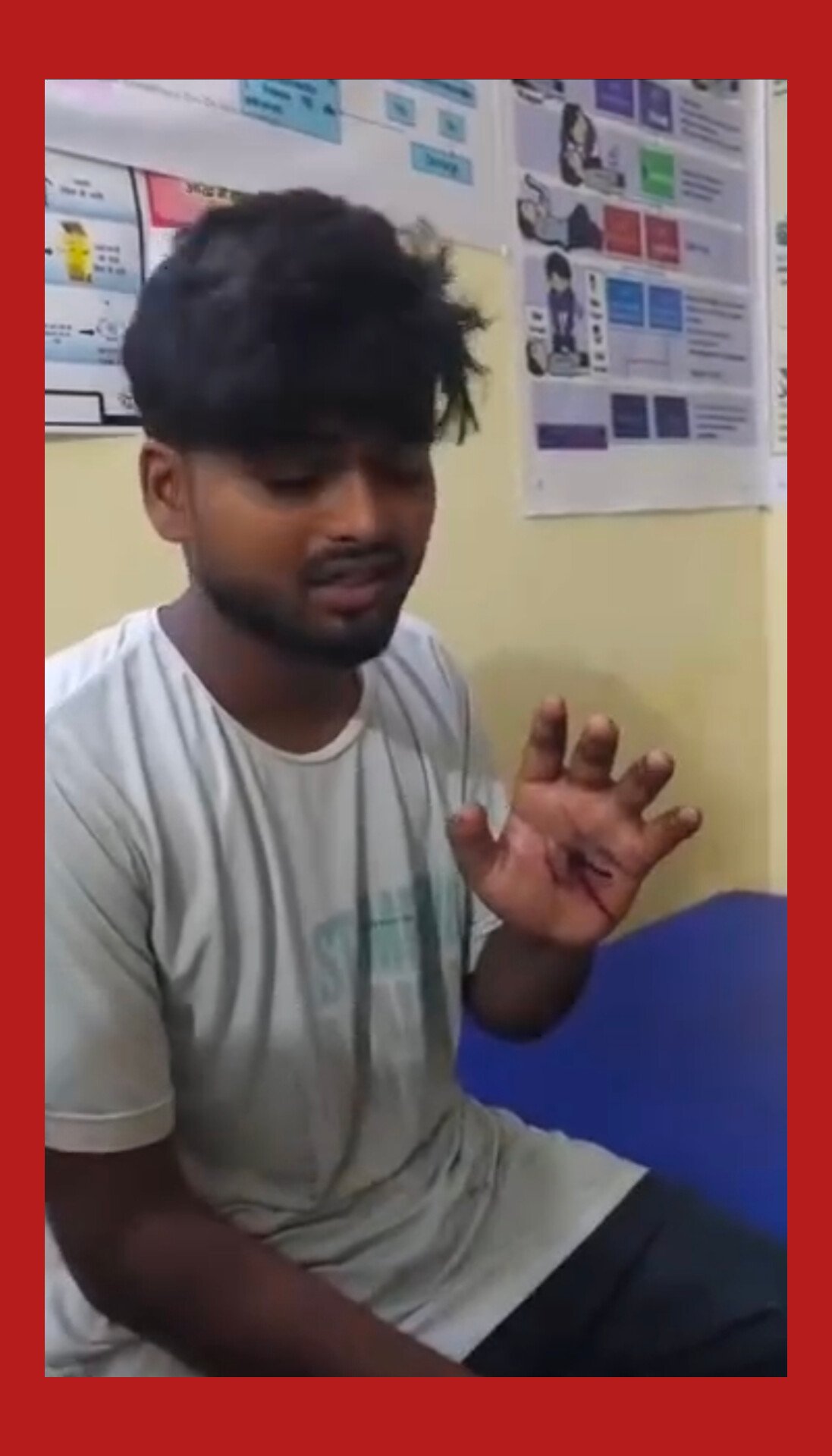 Chandauli Crime: चंदौली के नौगढ़ में 800 रुपये के विवाद में युवक पर फायरिंग, हाथ में लगी गोली, आरोपी की तलाश में जुटी पुलिस